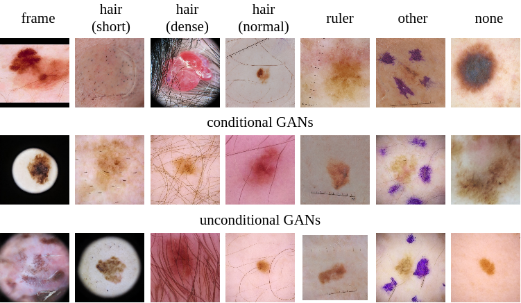 Example artifacts in real and GAN generated data