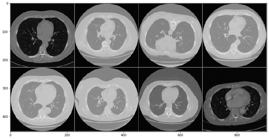 CT-images