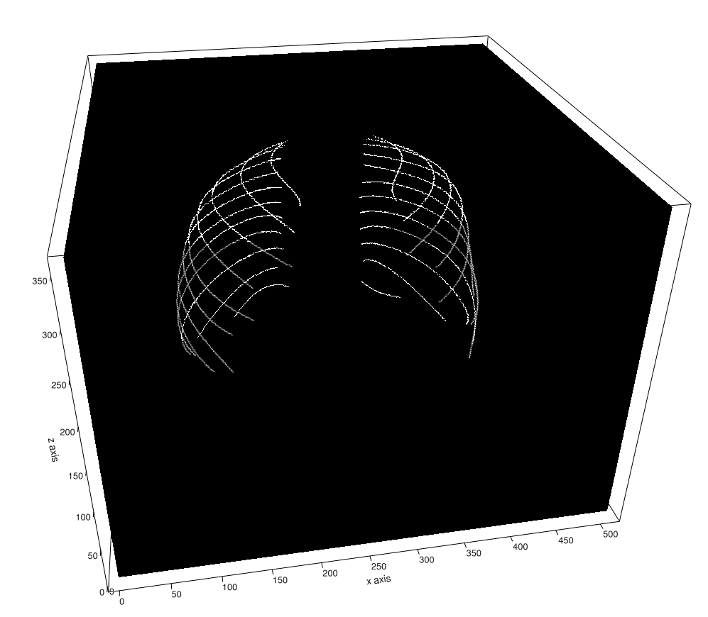 Rib Centerline