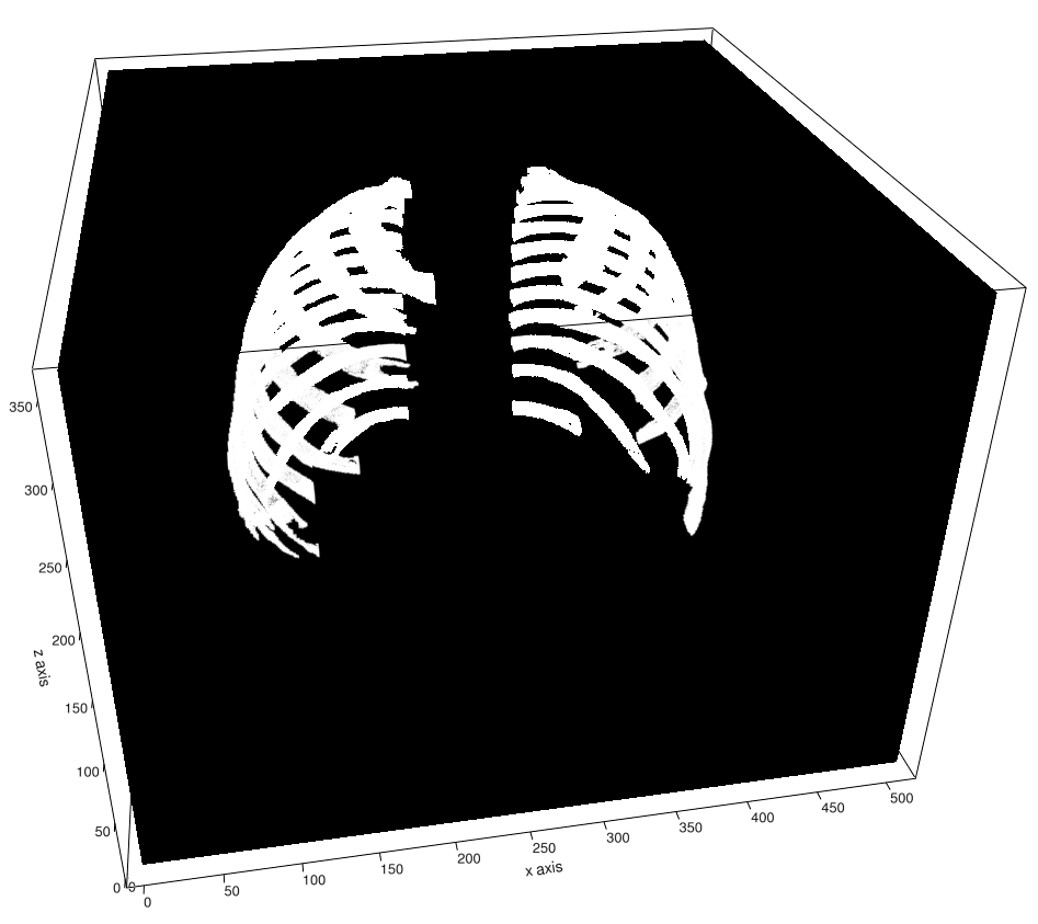 Rib Segmentation