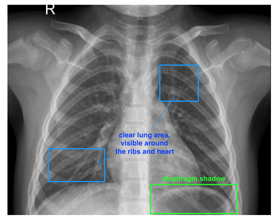 healthy xray example