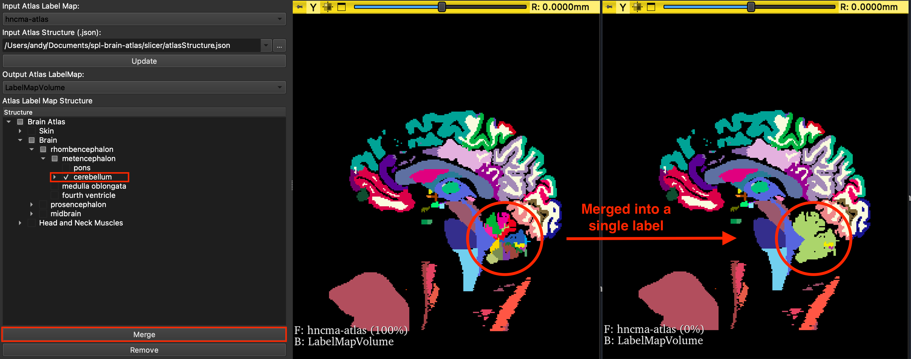 AtlasEditor module screenshot