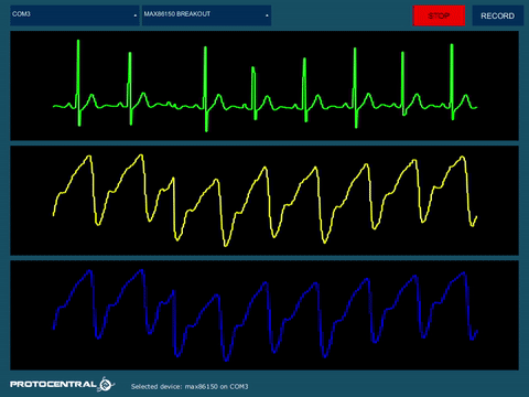 streaming in openview