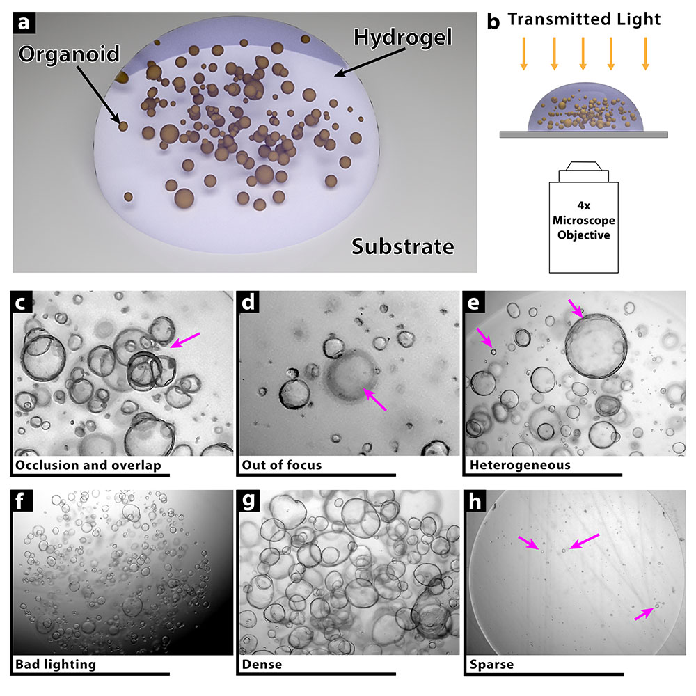 OrgaQuant for Measuring Organoid Diameter in 3D