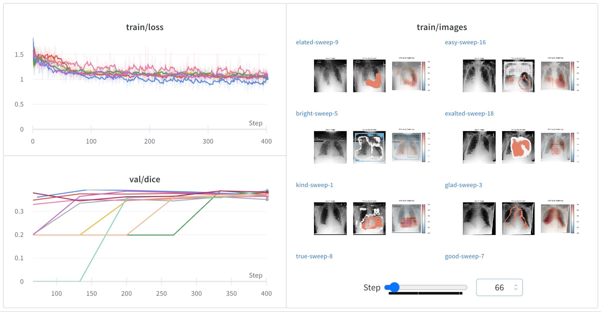 WandB training_Screenshot