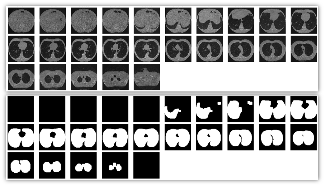 lung_slices_example