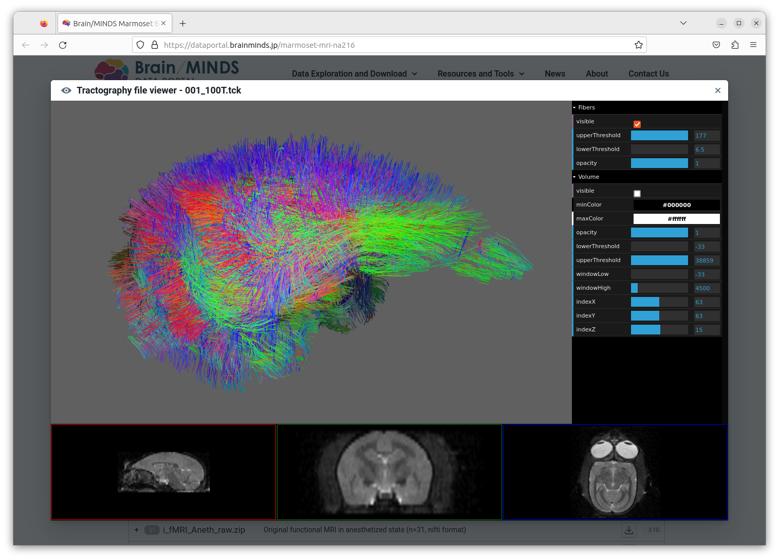 current tracto viewer