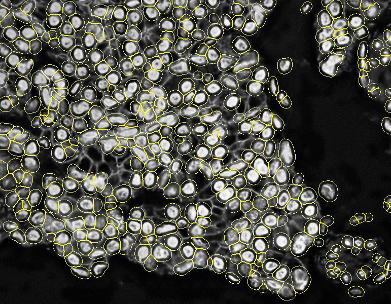 PIPEX segmentation 1