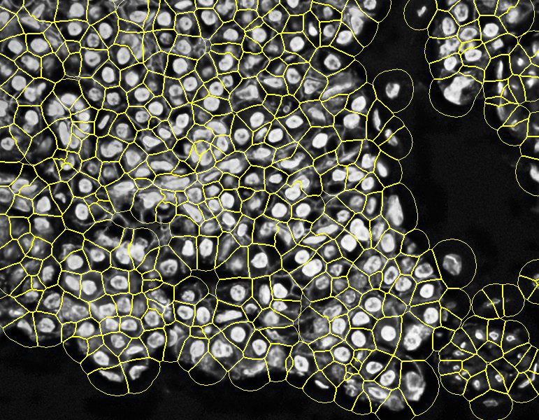 PIPEX segmentation 2