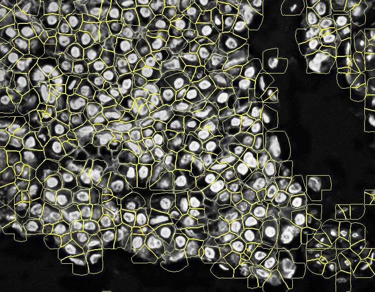 PIPEX segmentation 3