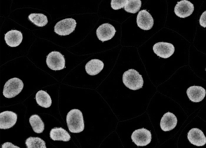 Nuclei sample 1