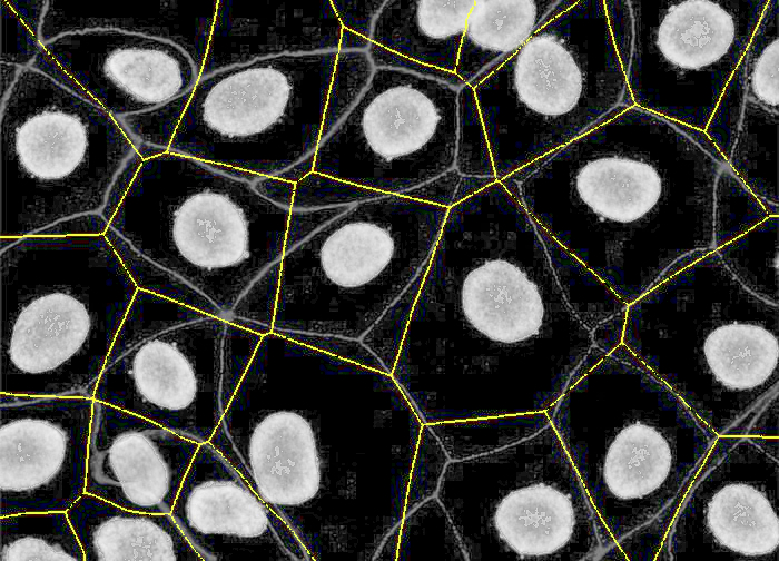 Stardist expanded segmentation