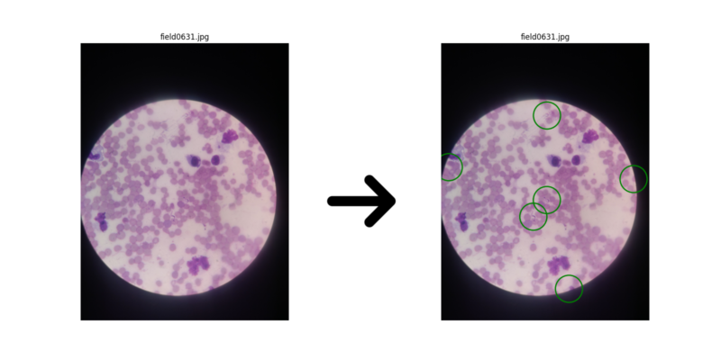 Example of detection T. cruzi in low-resolution image.