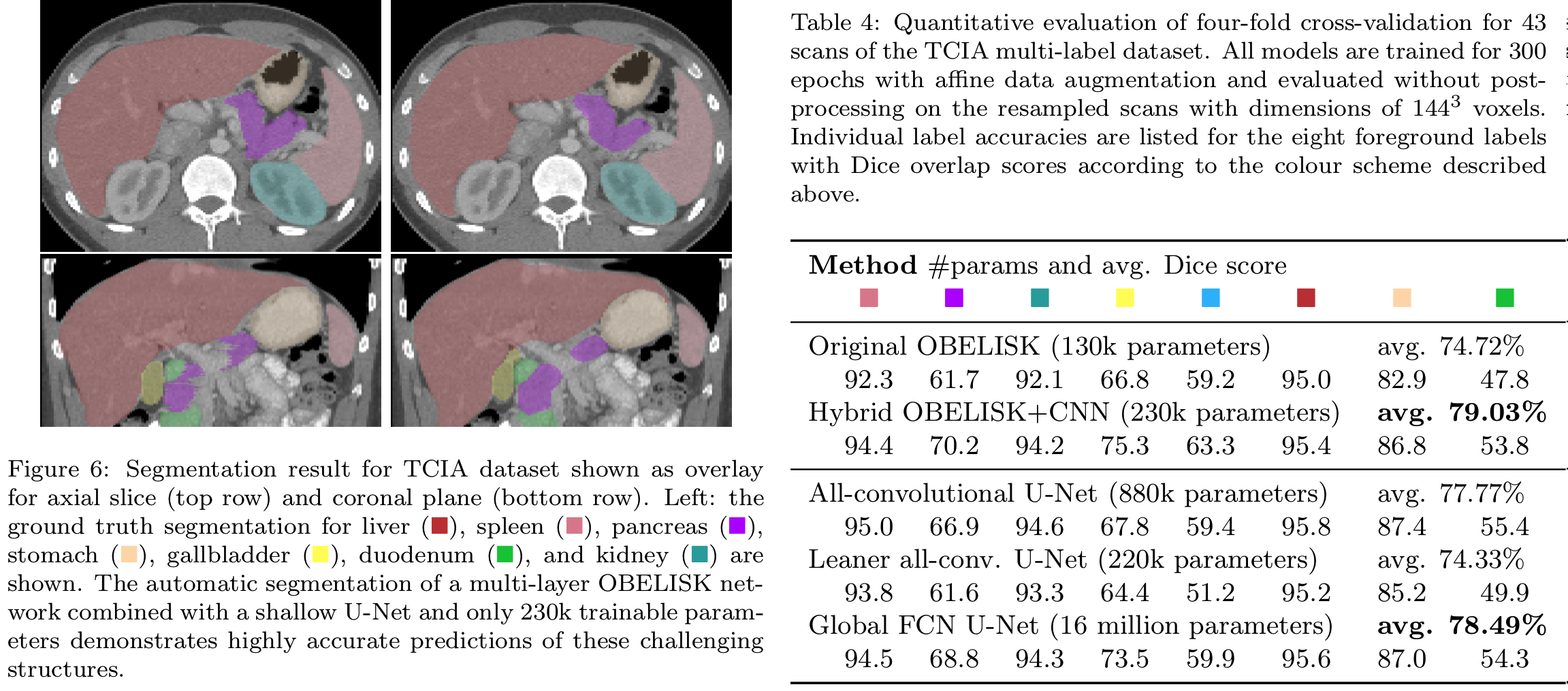 Visual Overlay and Table from MEDIA preprint