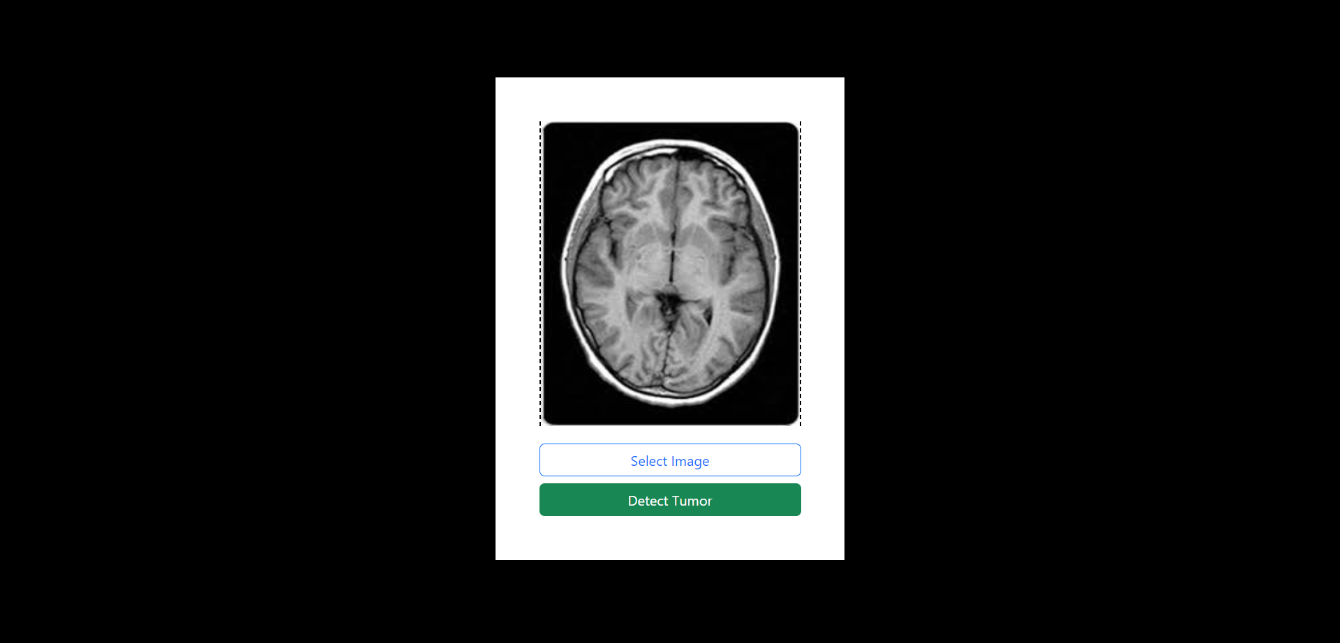 Brain Tumor X-Ray Classification App