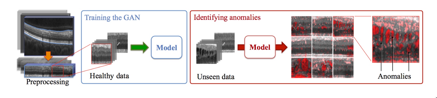 Model Structure