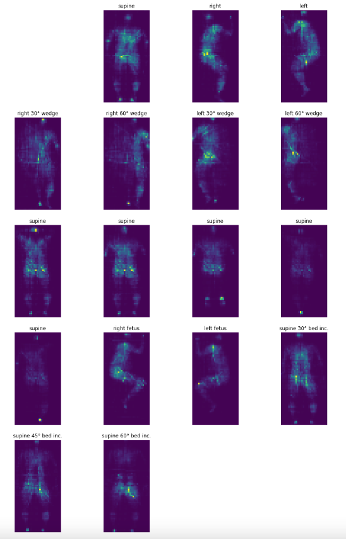 data visualization