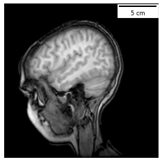 dx with extent